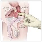 Prostate Health: Why It Matters and How to Take Care of It